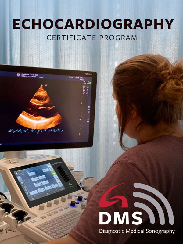 Echo Program